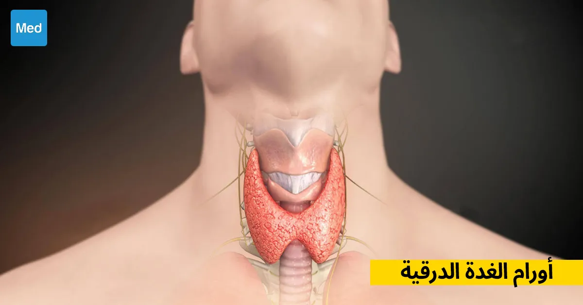 أورام الغدة الدرقية